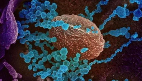 신종 코로나바이러스 배양 세포 표면에서 빠져나오는 신종 코로나바이러스(청색)의 전자현미경 이미지  [미 NIAID 제공 / 재판매 및 DB 금지]
