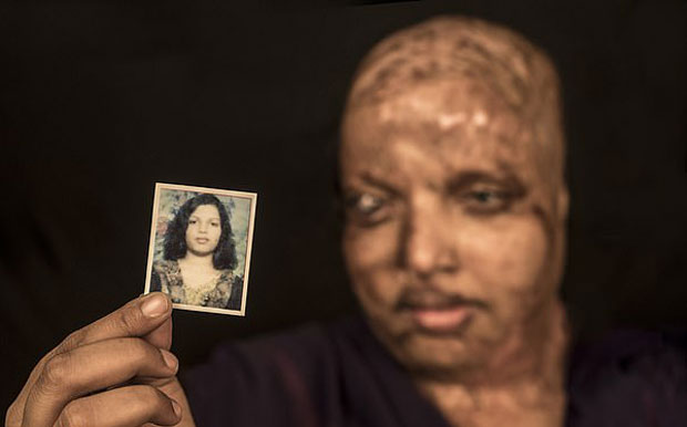 신부인 라울은 16살이었던 2009년 4월 황산테러로 얼굴을 잃었다. 피부와 머리카락이 모두 녹아내렸고 시력도 잃었다. 하반신 80%가 마비돼 5년 동안 병원 침대에 누워만 있어야 했다. 라울에게 테러를 가한 건 그녀를 일방적으로 쫓아다니던 또래 남성이었다.