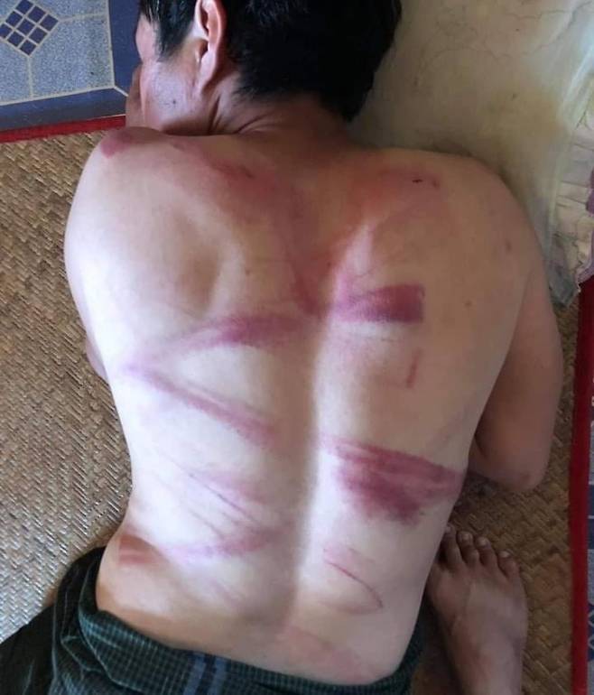 군경이 휘두른 쇠사슬에 맞은 시위자./사진=트위터(@BG_ICEICE)