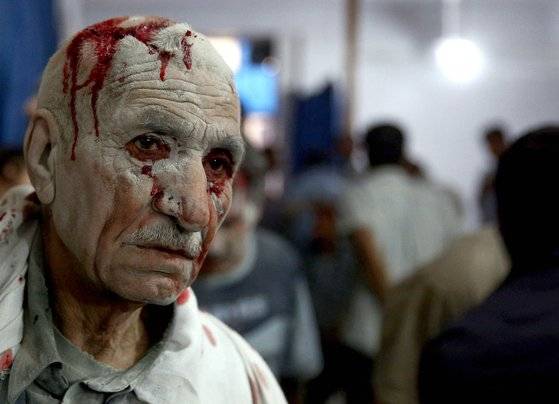 2015년 6월 30일 시리아 수도 다마그쿠스의 동부 두마에서 정부군의 폭격으로 부상 당한 노인이 임시 진료소에 도착해 진료 차례를 기다리고 있다. AFP=연합뉴스