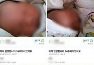 지난달 16일 당근마켓에 ‘아이 입양합니다. 36주 되어 있어요’라는 제목의 글이 올라왔다. 이 글을 올린 20대 미혼모는 출산과 산후조리 중 두려움과 막막함 속에서 입양기관 상담을 받고 입양 절차가 까다롭고 오래 걸려 이런 게시글을 올렸다고 경찰에 진술했다. 당근마켓 화면 캡처