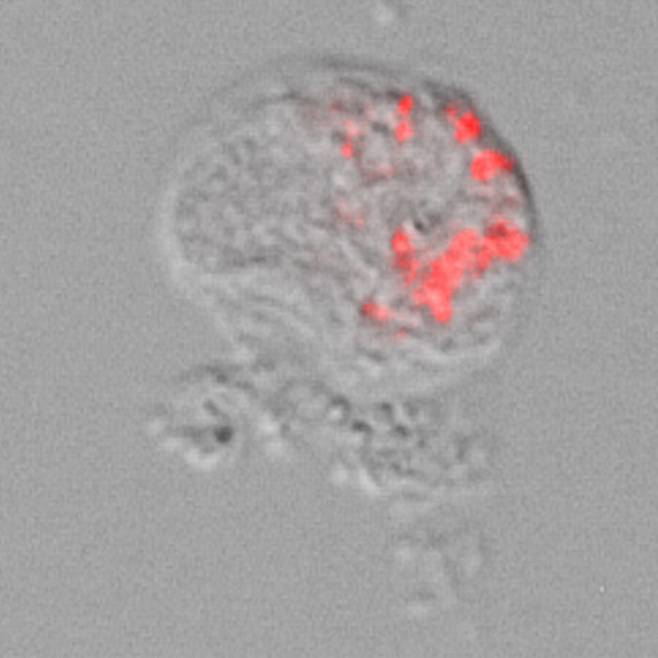아메바 내부에 기생하는 포켓모나스 (붉은색)의 현미경 사진과 이해를 돕기 위한 그림. Credit: Marcel Dominik Solbach
