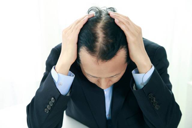 남성 호르몬이 과하게 분비돼 다이하이드로테스토스테론이 쌓이면 M형 탈모가 생길 수 있다./사진=클립아트코리아