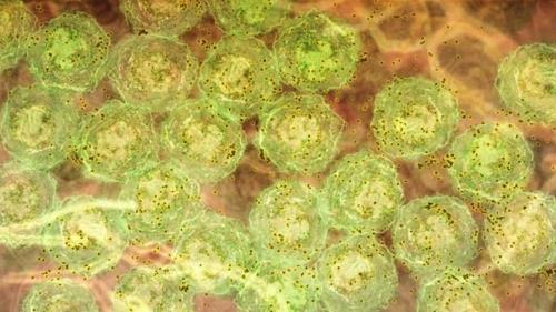 염증 신호를 받아 항체(갈색)를 형성하는 B세포(녹색) [월터 & 엘리자 홀 의학 연구소 / 재판매 및 DB 금지]
