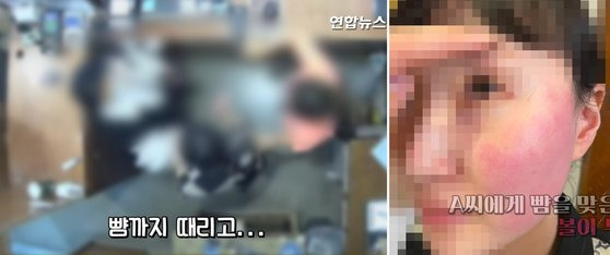 폭행 혐의로 경찰 조사를 받고 있는 주한 벨기에 대사 부인에게 뺨을 맞은 피해자인 옷가게 점원과 가족이 볼이 부은 사진과 폭행 당시 CCTV 영상을 지난달 20일 공개했다. 연합뉴스 TV 캡처