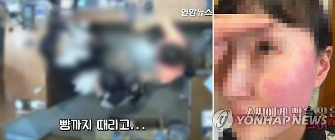 옷가게 점원 폭행하는 대사부인 CCTV 공개 (서울=연합뉴스) 폭행 혐의로 경찰 조사를 받는 주한 벨기에 대사 부인에게 뺨을 맞은 피해자인 옷가게 점원과 가족이 볼이 부은 사진과 폭행 당시 CCTV 영상을 20일 공개했다. 2021.4.20  [연합뉴스 TV 캡처] photo@yna.co.kr