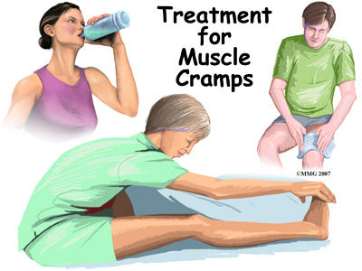 출처: https://eorthopod.com/muscle-cramps/