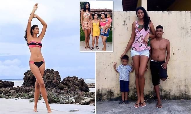 ‘키 차이 40㎝’ 남성과 결혼한 ‘207㎝’ 브라질 여성 근황