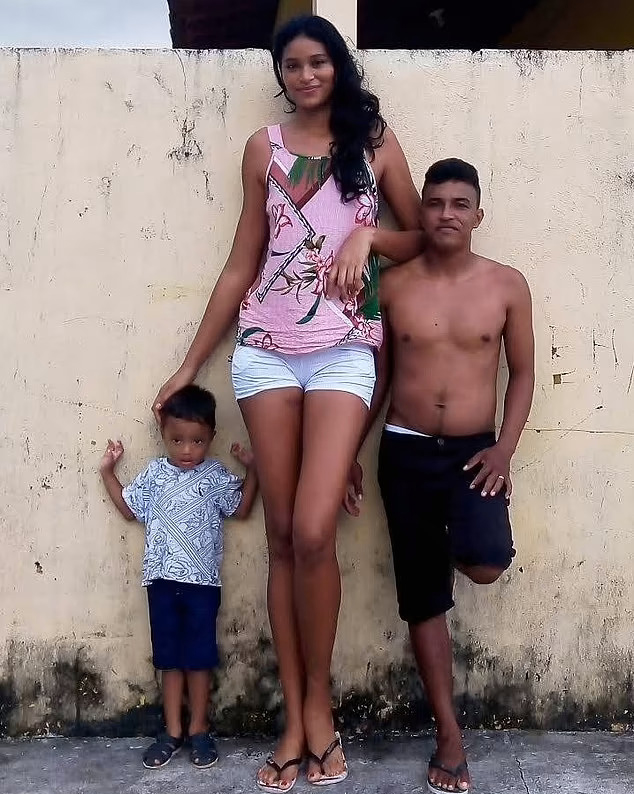 브라질 최장신녀로 불리는 엘리자니 시우바(26)는 자신보다 키가 40㎝ 이상 작은 남성 프란시나우두 다시우바 카르발류(31)와 결혼해 아들 안젤루(3)를 낳았다.