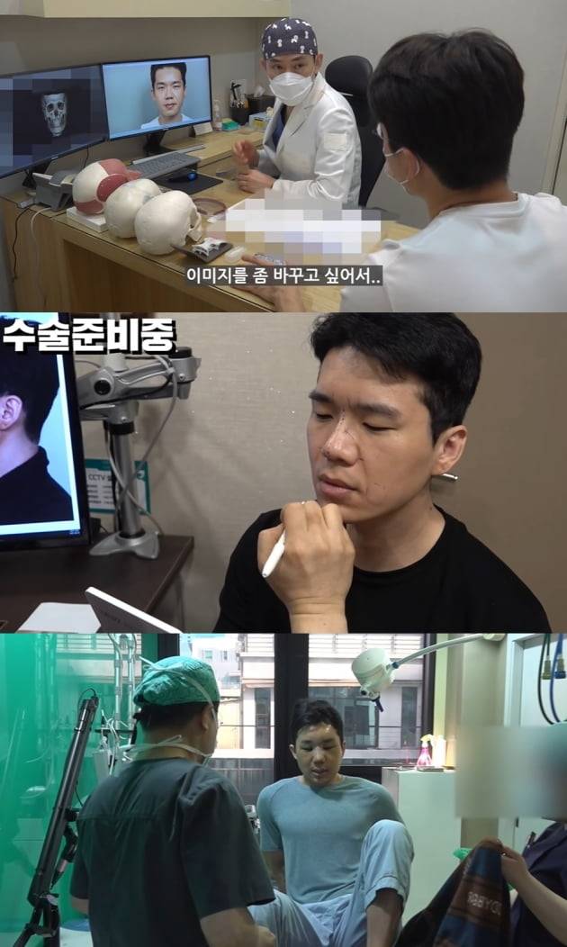 여혐 논란으로 곤혹을 치른 보겸이 성형 수술을 했다고 밝혔다. /사진=유튜브 보겸TV