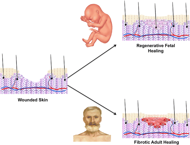 50년 전인 1971년 양의 태아에서 상처가 흉터없이 치유된다는 사실이 발견됐다. 그 뒤 사람에서도 24주 이전 태아까지 그러다가 이후 이런 능력을 잃는 것으로 밝혀졌다. 포유류 상처 치유 흔적 유무의 미스터리가 50년 만에 풀렸다. ‘생의학공학 연감’ 제공