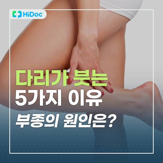 다리가 붓는 5가지 이유