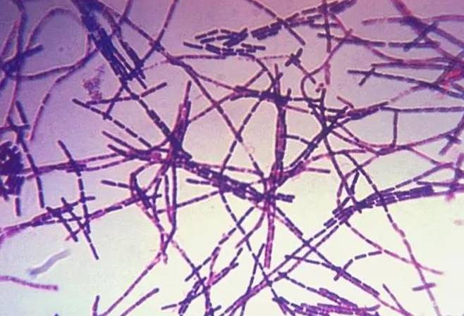 탄저균 [베이징시 질병예방통제센터 위챗 캡처. 재판매 및 DB 금지]