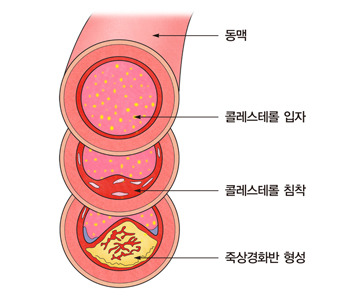 서울아산병원 제공