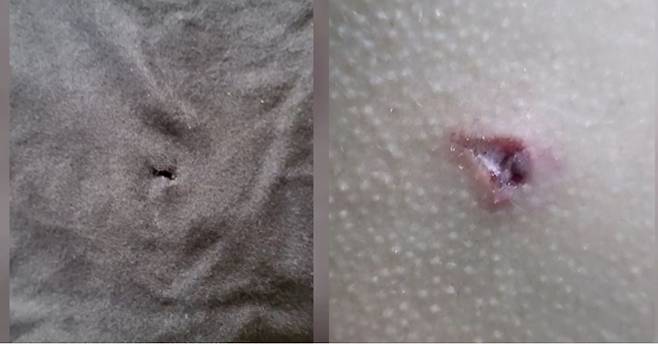 화살에 뚫린 피해 학생의 옷과 상처 입은 등. /KBS