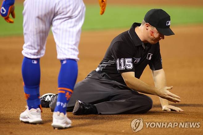 송구에 얼굴을 맞은 1루심 주니어 밸런타인 [AFP-연합뉴스]