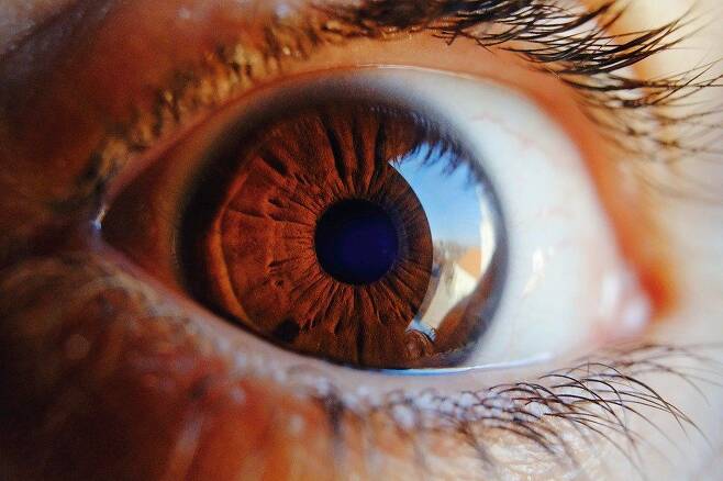 나이가 들어 눈에 심각한 질환이 생기면 알츠하이머 치매 위험도 높아진다는 연구 결과가 나왔다./Pixabay