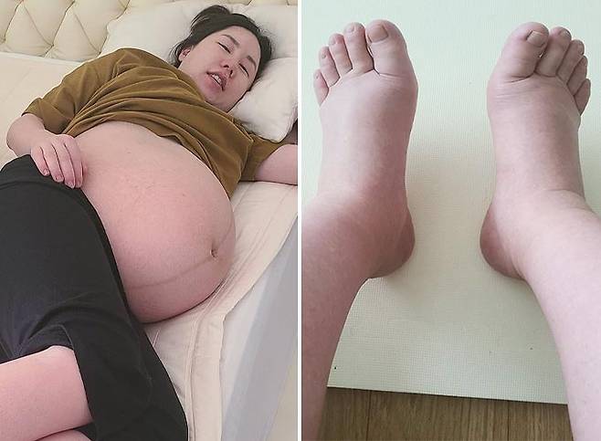 코미디언 황신영/사진=황신영 인스타그램