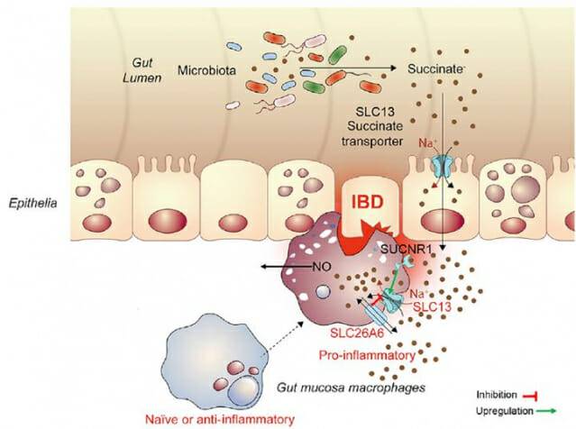 세포로의 숙신산 유입경로와 대장 염증 악화 과정(사진=세브란스병원)