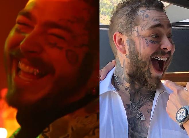 /사진=가수 포스트 말론, 치과의사 토마스 코넬리 인스타그램