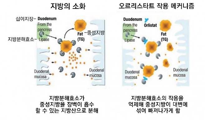 1999년 FDA 승인을 받은 오르리스타트(제품명 제니칼)는 비만치료제를 상징하는 약물로 대중에게 각인돼 있다. 음식을 먹으면 위에서 대충 소화가 된 뒤 십이지장에서 지방분해효소(lipase)가 중성지방(fat(TG))을 장벽이 흡수할 수 있는 지방산으로 분해한다(왼쪽). 오르리스타트(orlistat)는 지방분해효소의 작용을 억제해 중성지방이 대변에 섞여 빠져나가게 한다(오른쪽). 자료 메드익스프레스