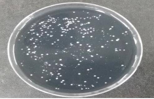 레지오넬라균 [서울시 제공. 재판매 및 DB 금지]