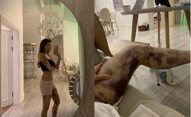 아옳이(김민영) 인스타그램