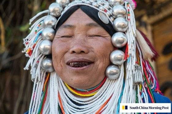 빈랑 열매를 씹고 이빨이 빨갛게 물든 중국의 한 시민. /사진=홍콩 사우스차이나모닝포스트