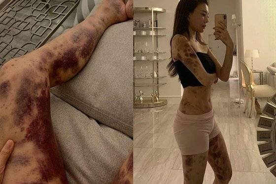 [아옳이 인스타그램 캡처]