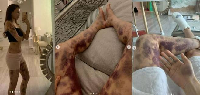 아옳이 인스타그램