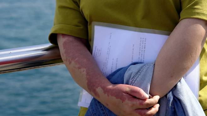 인터뷰 전날 밤, 하고픈 말이 많아 잠을 잘 이루지 못했다고 했다. 누군가 그의 말을 오롯이 들어준 것도 거의 처음이었으리라./사진=이주아 머니투데이 PD