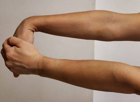 사진1) 정적, 수동적 스트레칭의 예