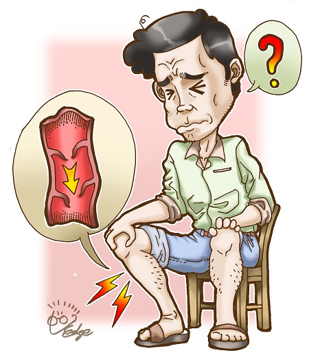 하지정맥류는 문제 혈관을 겉으로 확인하기 어려운 잠복성 하지정맥류도 있어 혈관 돌출 외 다리에 공통적으로 나타나는 증상들을 잘 알아두는 것이 중요하다(사진=민트병원).