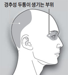 뒷골 당기는 사람, 머리 아닌 '이 곳' 문제