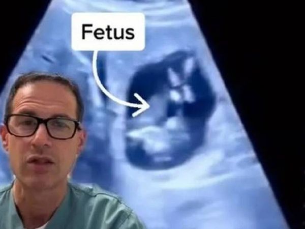 캐나다의 한 의사가 현지에서 확인한 간 자궁 외 임신 환자의 초음파 영상을 공개했다