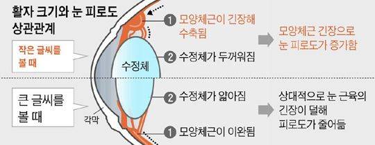 사물의 거리에 따라 변하는 수정체는 가까운 것을 볼 때 두꺼워지며 눈의 피로를 유발한다.사진=조선일보 DB