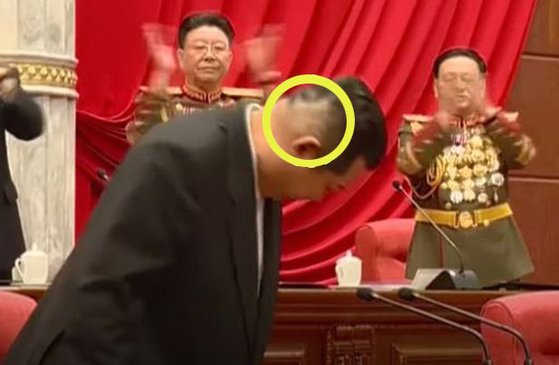 지난주 8기 4차 전원회의를 주재한 김정은 북한 국무위원장의 오른쪽 뒤통수에 의료용 테이프를 붙였다 뗀 자국이 보인다. 사진 조선중앙TV 방송화면 캡처
