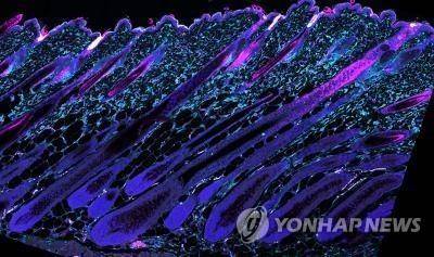 탈모 원인은 모낭 줄기세포 감소 [연합뉴스 사진자료]