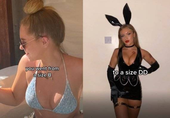 피임약 복용 전후로 달라진 자신의 가슴 크기를 SNS에 업로드 한 다르시. /사진=다르시 틱톡