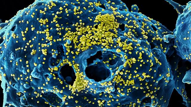 코로나19 바이러스(노란색)가 동물세포에 붙어 있는 모습을 전자현미경으로 찍은 사진.미국 국립알레르기·감염병연구소(NIAID) 제공