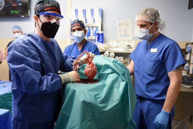 미국 메릴랜드대 의대 연구진이 지난 7일 수술실에서 말기 심장병 환자에게 이식할 유전자 조작 돼지 심장을 들어보이고 있다. 동물의 심장이 사람에게 이식된 세계 의학계의 첫 시도이자 첫 성공 사례가 됐다. /메릴랜드 의대