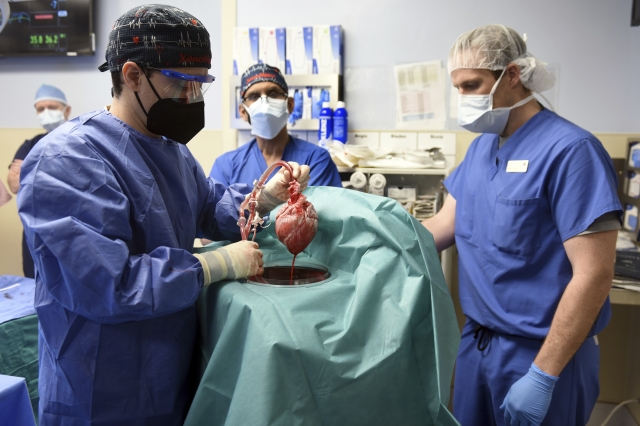 돼지 심장 인체에 첫 이식 수술하는 미 메릴랜드대 의료진. AP연합뉴스