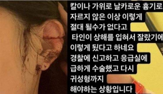 온라인커뮤니티 캡처