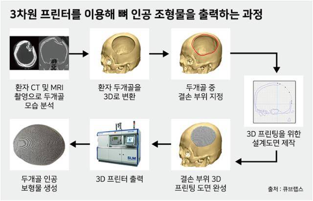 시각물_3차원 프린터를 이용해 뼈 인공 조형물을 출력하는 과정