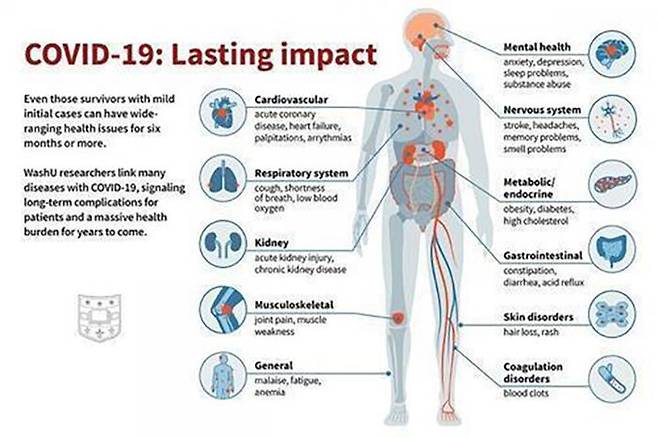코로나 회복 6개월 이내에 나타날 수 있는 후유증 (사진=미국 세인트루이스 워싱턴 의대 Sara Moser 제공, 연합뉴스)