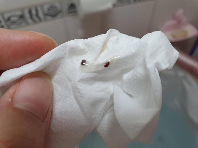 샴푸통 안에서 나왔다고 주장되는 권연벌레 사진 / 사진=보배드림