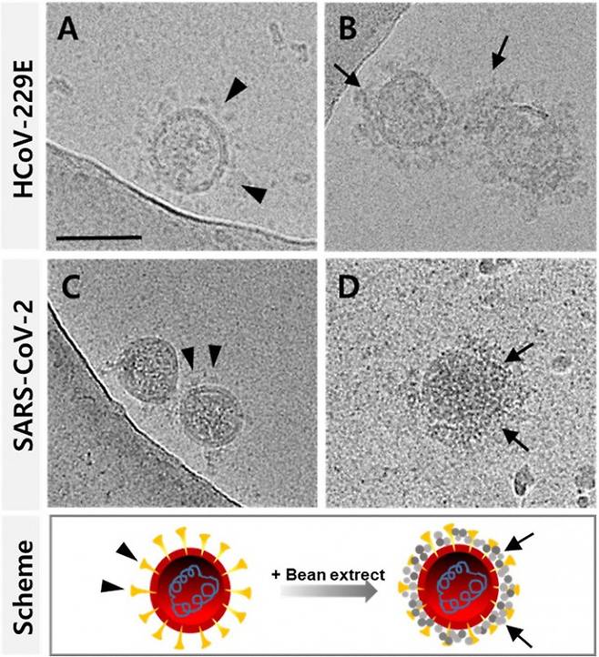 빈 가드 가글이 코로나바이러스 검체를 채취하는 것을 확인하는 현미경 영상과 원리 일러스트. 현미경 영상에서 위 사진이 감기를 일으키는 사람코로나바이러스, 아래가 코로나19 바이러스다. 각각 오른쪽 사진에서 가글 성분이 바이러스를 둘러싼 것을 확인할 수 있다. 전남대 제공