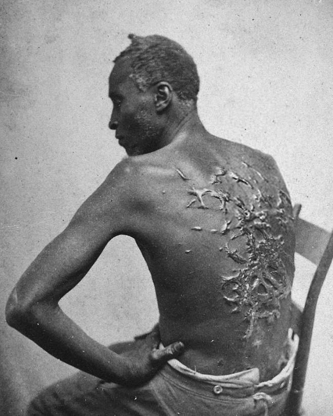 구타와 학대를 당한 흑인노예. 출처  | 미국 National Archives and Records Administration