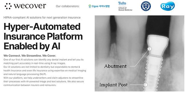 국내 연구진이 세운 스타트업 '위커버'가 최근 카카오벤처스의 투자를 받았다. 사진은 '위커버' 홈페이지. [사진=위커버 홈페이지 갈무리]
