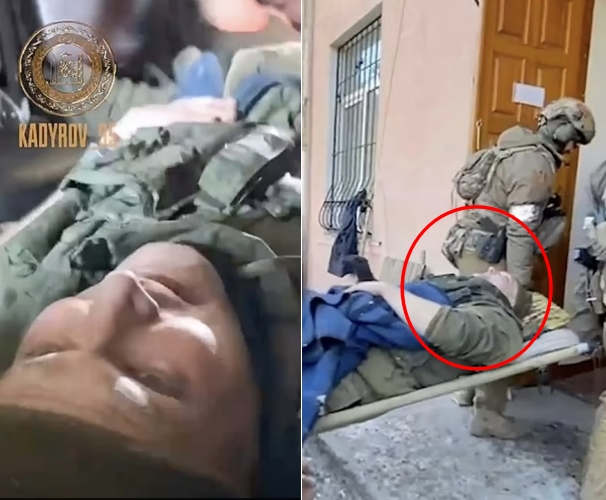 23일 러시아군의 유리 메드베데프 대령으로 알려진 장교가 양다리에 중상을 입고 들것에 실려 병원으로 들어가는 영상이 공개됐다. 2022.03.26